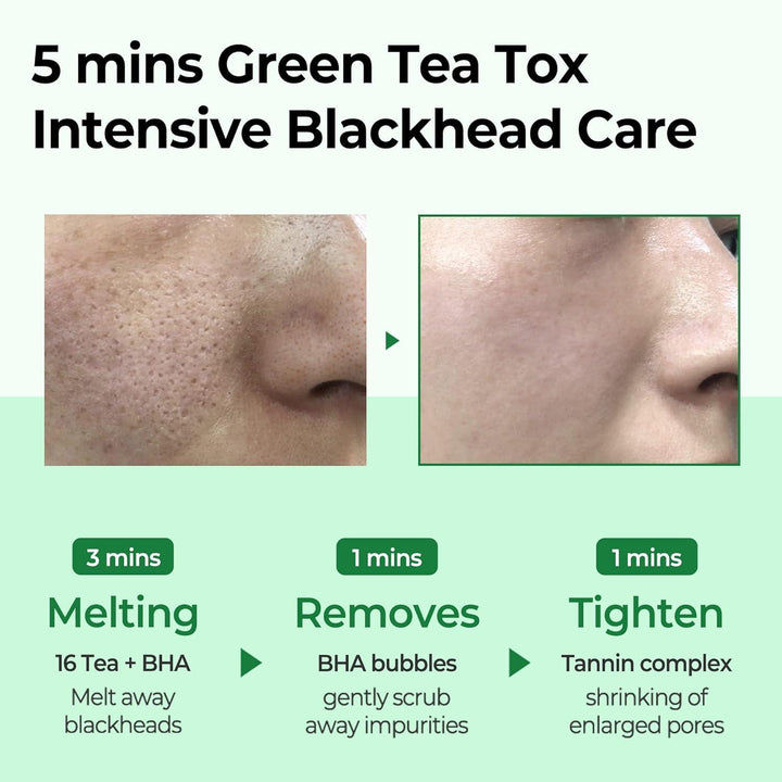 Some By Mi BYE BYE BLACKHEAD 30 DAYS MIRACLE GREEN TEA TOX BUBBLE CLEANSER 120g