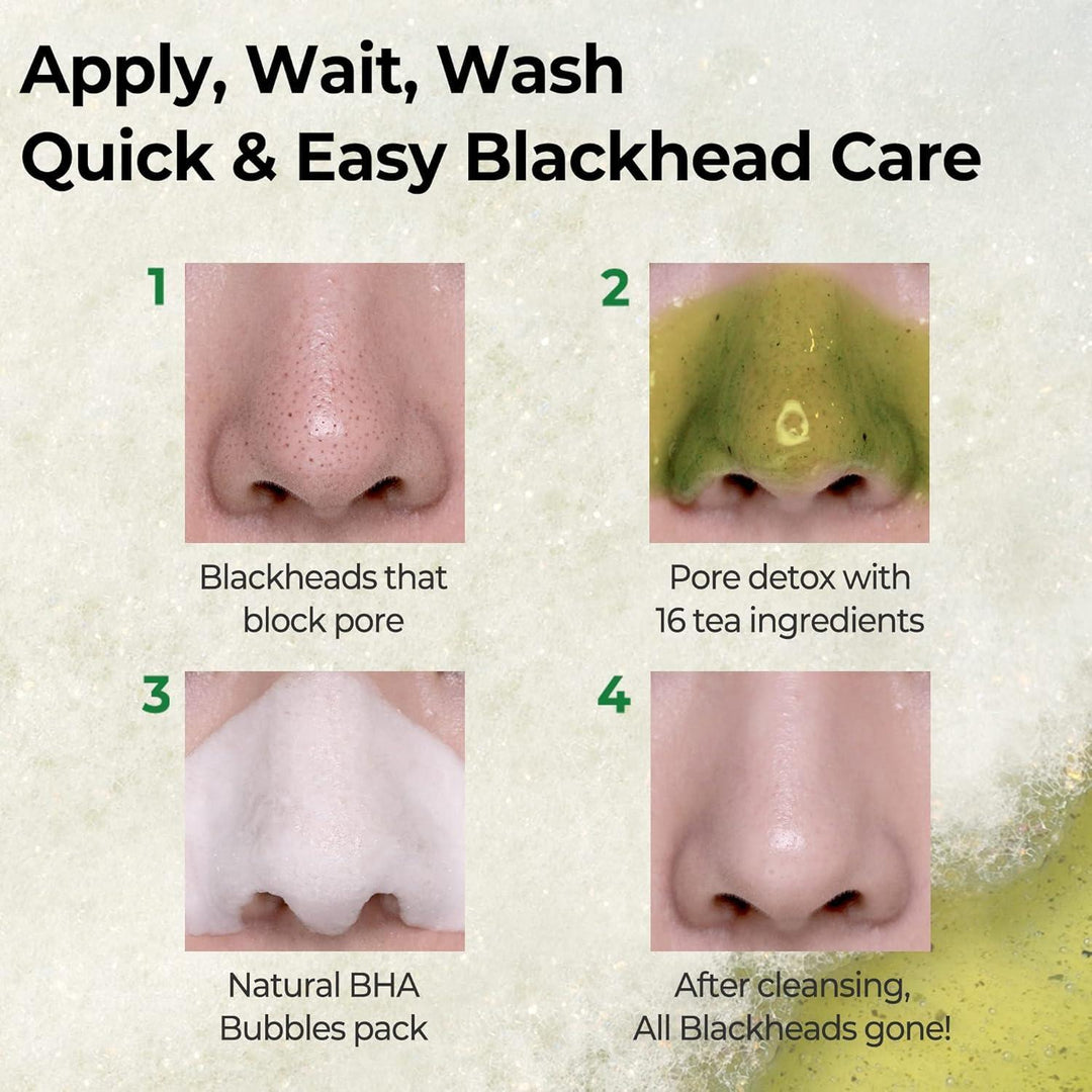 Some By Mi BYE BYE BLACKHEAD 30 DAYS MIRACLE GREEN TEA TOX BUBBLE CLEANSER 120g
