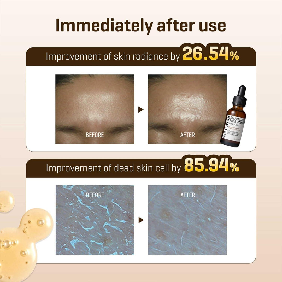 Some By Mi GALACTOMYCES PURE VITAMIN C GLOW SERUM 30ml