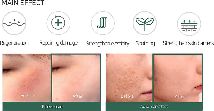 Some By Mi AHA-BHA-PHA 30DAYS MIRACLE CREAM 60g