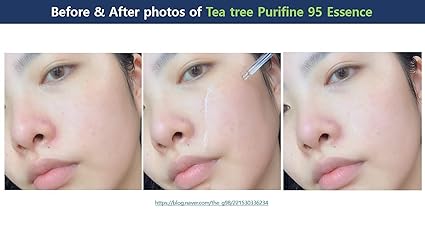 Dr.Ceuracle Tea Tree Purifine 95 Essence 50ml