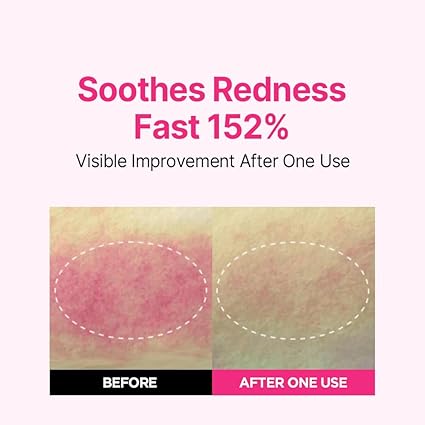 ISOI Bulgarian Rose Blemish Care Up Serum 35ml