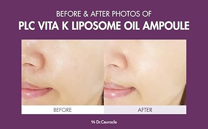Dr.Ceuracle PLC VITA LIPOSOME OIL AMPOULE 50ml