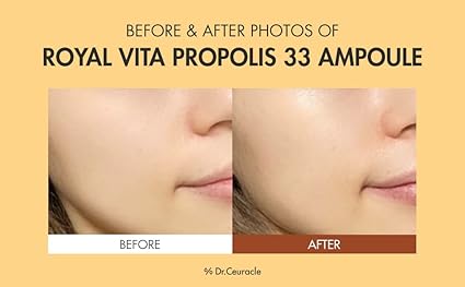 Dr.Ceuracle Royal Vita Propolis 33 Ampoule 15ml