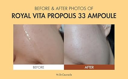 Dr.Ceuracle Royal Vita Propolis 33 Ampoule 15ml