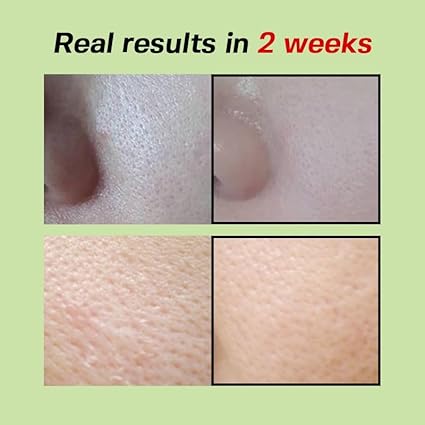 SUNGBOON EDITOR Green Tomato Pore Lifting Ampoule 75ml