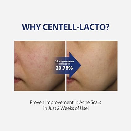 SUNGBOON EDITOR Centell Lacto Ac Less skin Barrier Essence 30ml