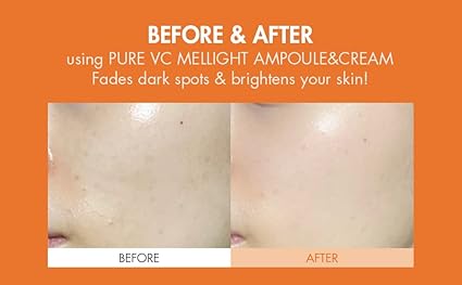 Dr.Ceuracle PURE VC MELLIGHT CREAM 20g