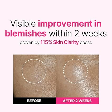 ISOI Bulgarian Rose Blemish Care Up Serum 35ml