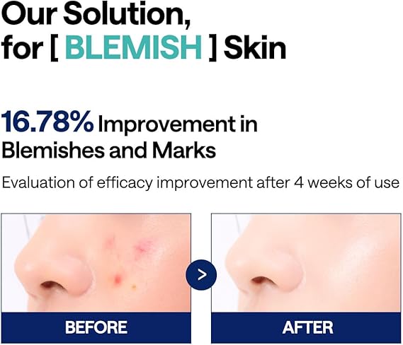 Mediheal Madecassoside Blemish Pad 100ea