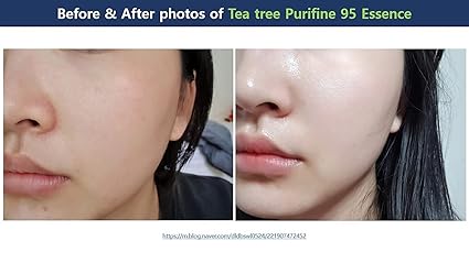 Dr.Ceuracle Tea Tree Purifine 95 Essence 50ml