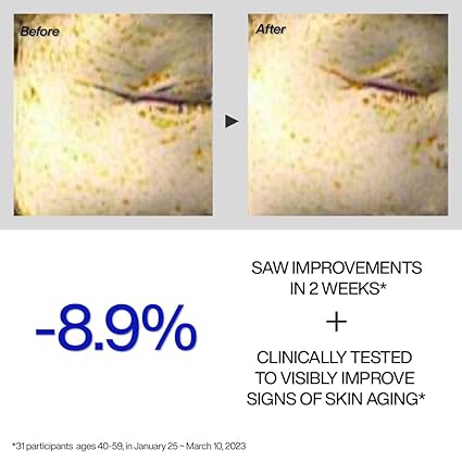 IOPE Retinol Expert 0.1% 30ml