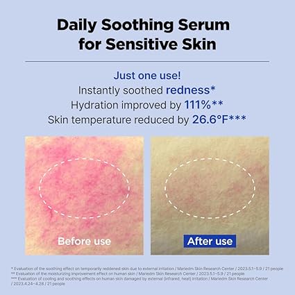 ISOI Acni Dr. 1st Control Serum 40ml