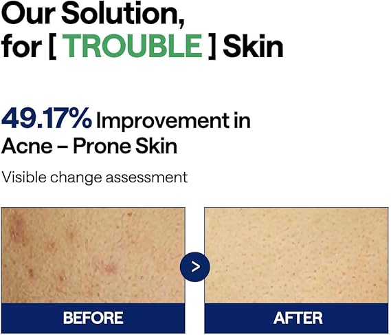Mediheal Teatree Trouble Pad 100ea