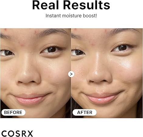 Cosrx The Hyaluronic Acid 3 Serum 20ml