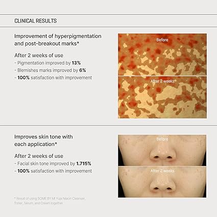 Some By Mi Yuja Niacin Anti Blemish Care Cream 60g