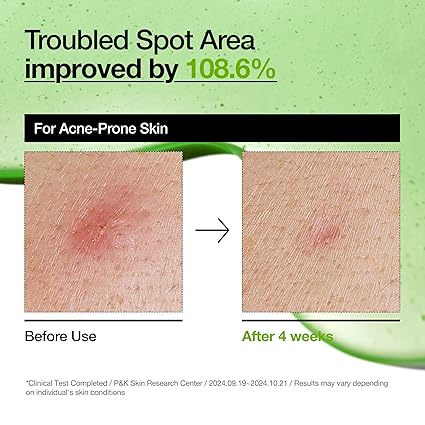Anua AZELAIC HYALURON SOOTHING SERUM 30ML