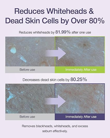 Centellian 24 Real Green Pore Nose Pack (5set/1box)
