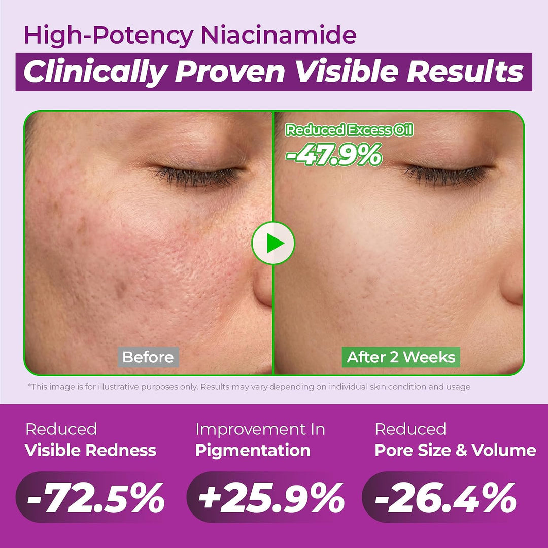 Jumiso Niacinamide 10% Serum 40ml
